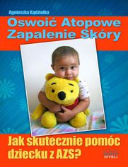 Oswoi atopowe zapalenie skry